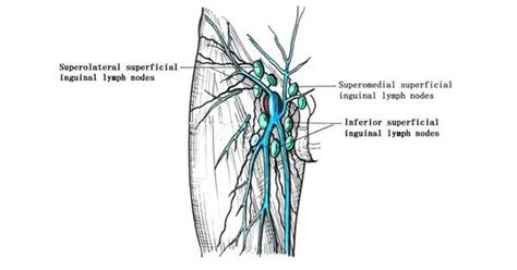 left inguinal lymph node
